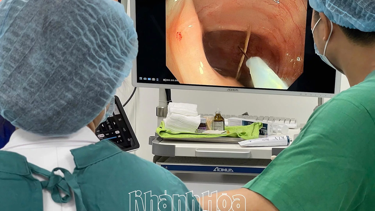 Hôpital 22-12 : Une intervention endoscopique a permis de retirer avec succès trois os longs du côlon du patient.