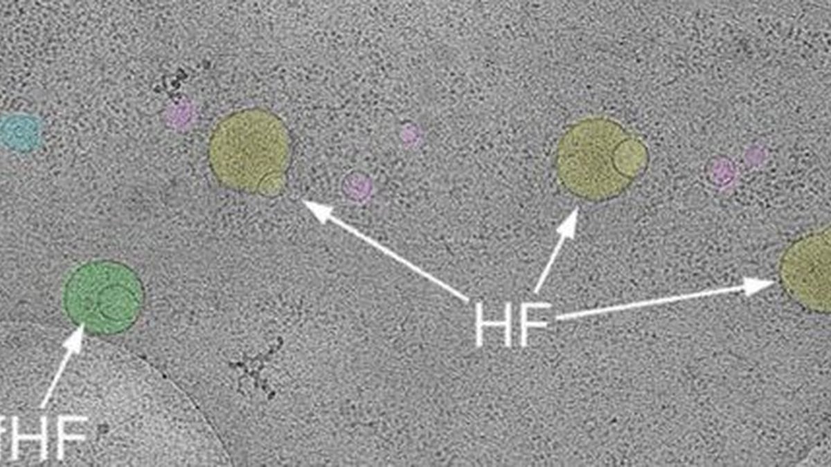 ヒト細胞内に全く新しい構造が発見される