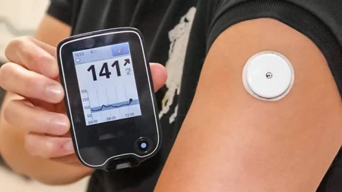 Continuous blood glucose monitoring devices: More harm than good