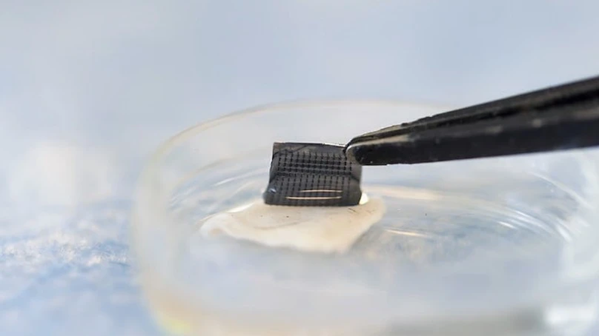 At-home patch could help detect skin cancer