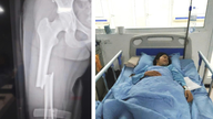 Khát vọng giảng đường đại học dang dở của nữ sinh mồ côi gặp tai nạn giao thông nghiêm trọng
