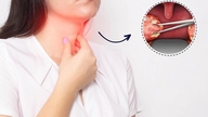 مزایا و خطرات جراحی لوزه