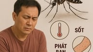 WHO varoittaa chikungunya-taudin vaarasta Vietnamissa.
