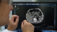 Kina integrerer aggressivt kunstig intelligens i sygdomsdiagnose, hvilket rejser en række spørgsmål.