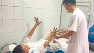 El clima frío aumenta el riesgo de sufrir un derrame cerebral.