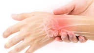 Manifestationen der juvenilen idiopathischen Arthritis bei Kindern.