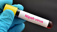 Kementerian Kesihatan menyediakan panduan mengenai diagnosis dan rawatan penyakit virus Nipah.
