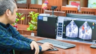 Anak berusia 2 tahun itu telah menjalani operasi jantung sebanyak tiga kali.