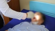 77-vuotiaan naisen leukalihakseen oli juuttunut kalanruoto, jonka havaitsemiseksi tehtiin tietokonetomografia.