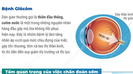 Mergeți în mod proactiv la controale oftalmologice regulate pentru a diagnostica glaucomul din timp.