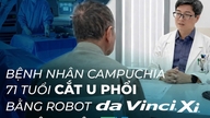 Un paciente camboyano de 71 años fue sometido a una extirpación de un tumor pulmonar utilizando el sistema robótico da Vinci Xi en el Hospital FV.