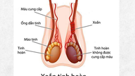 Un garçon de 14 ans a dû subir une ablation des testicules en raison d'une hospitalisation tardive.