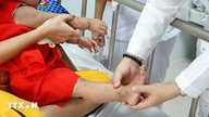 Sunt necesare mai multe internări și tratamente, pe măsură ce cazurile de boală mână-gură-picior sunt în creștere.