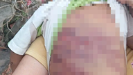 Mehr Anrufe, weniger Leid für misshandelte Kinder.
