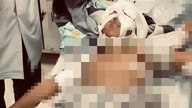 Tay Ninh: un bambino di 11 anni è rimasto gravemente ferito dopo essere stato aggredito da un pastore tedesco.
