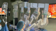 Application de la chirurgie endoscopique robotisée au traitement du cancer de la prostate.