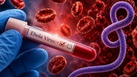 Sundhedsministeriet aktiverer foranstaltninger som reaktion på risikoen for, at ebola kommer ind i Vietnam.