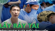 집에서 귀지를 제거하려다 환자가 영구적인 청력 손실을 입을 뻔했습니다.