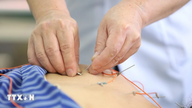 Standardisering af viden om traditionel medicin gennem videnskab og data.