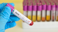 Il principio "2-5-30" previene la diffusione dell'Ebola.