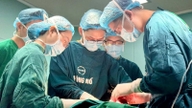 Desfiguración facial causada por un pequeño lunar en la mejilla.