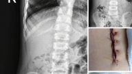 Nghe An Obstetrics and Pediatrics Hospital's information about a surgery to remove a foreign object from a child has sparked outrage and anger on social media.
