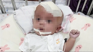 脳腫瘍を患う生後2ヶ月の男の子が手術で命を救われた。