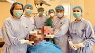 Păstrarea fertilității pentru o fată de 16 ani cu o tumoră ovariană de aproape 15 kg.