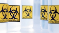 Les Ã‰tats-Unis rÃ©vÃ¨lent de maniÃ¨re inattendue la vÃ©ritÃ© sur les laboratoires biologiques en Ukraine.