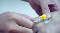 Vietnam erforscht und wendet neue, wirksame Krebstherapien an.