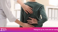 Dấu hiệu giúp cha mẹ nhận biết sớm trẻ bị cong vẹo cột sống