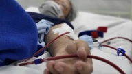 Un homme de 49 ans souffrant d'insuffisance rénale terminale s'est vu conseiller par les médecins d'éviter trois habitudes nocives que tout le monde devrait éviter.