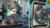 Ablation réussie d'une tumeur ovarienne pesant environ 5 kg.
