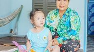 La Sra. Nguyen Thi Trang necesita ayuda para cubrir el costo de la cirugía para extraer los implantes metálicos de su pierna.