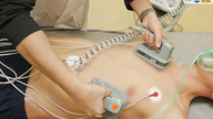 Cardioversie helpt een vrouw om een ​​beroerte te voorkomen, zelfs 20 jaar na een hartoperatie.