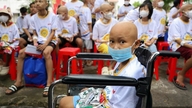 Lebih 2 bilion VND didermakan untuk menyokong pesakit kanser kanak-kanak yang "bangun dari katil hospital mereka".