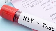 Jak długo po stosunku bez zabezpieczenia należy wykonać test na obecność wirusa HIV?