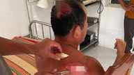 Balıkçı tekneleri başka bir gemiyle çarpışmanın ardından battıktan sonra, yaralanan balıkçılar kıyıya kadar bir deniz mili yüzdüler.