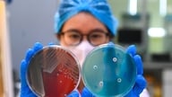 Multiresistente bakterier er en utfordring for sykehusbehandling.