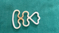Setelah melupakan keberadaan IUD-nya selama lebih dari 40 tahun, seorang wanita lanjut usia harus dirawat di rumah sakit untuk menjalani prosedur pengangkatan IUD tersebut.
