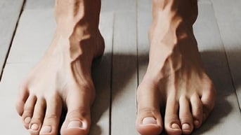Phải đi khám nếu thấy những dấu hiệu bất thường ở bàn chân