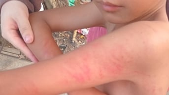 Con học lớp 1 bị cô giáo đánh, mẹ đến trường tát cô, chủ tịch huyện vào cuộc