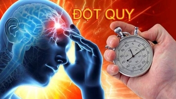 Phát hiện đột quỵ não sau cơn đau đầu