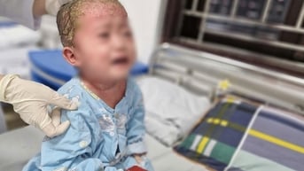 Bé trai 2 tuổi trợt loét, chảy dịch khắp cơ thể do cha mẹ tự ý làm điều này
