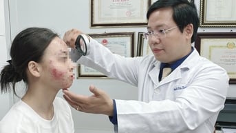 Uống thuốc tránh thai trị mụn, cô gái rước họa vào thân