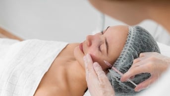 5 vùng trên mặt dễ bị tai biến khi tiêm filler