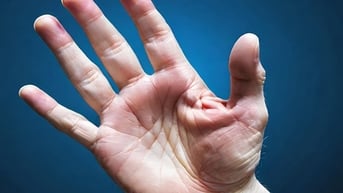Vì sao người mắc bệnh gan lại hay ngứa da?