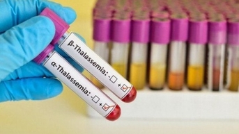 Chỉ số hồng cầu nhỏ báo hiệu bệnh Thalassemia