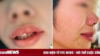 Xử phạt hành chính thầy giáo xông vào nhà hành hung nữ đồng nghiệp ở Đắk Nông