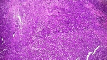 Giải phẫu bệnh - Cuộc cách mạng trong chẩn đoán bệnh chuyên sâu